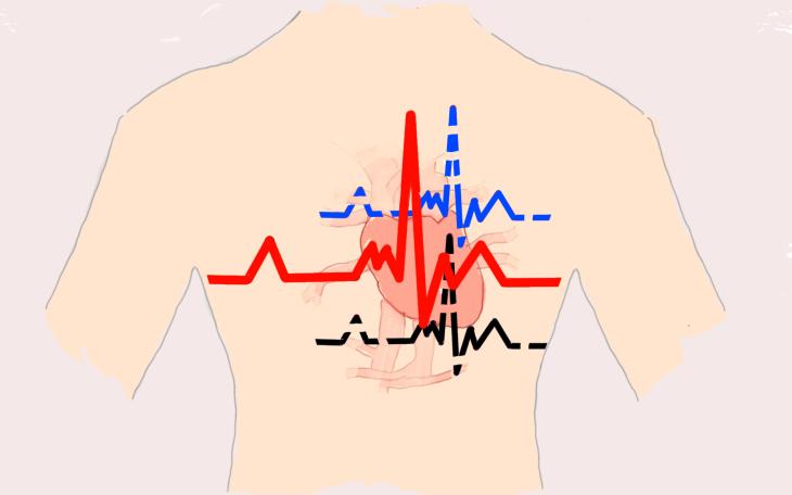 EKG Aurich - Elektrokardiografie Herzuntersuchung Kardiologie Praxis Mina Attia