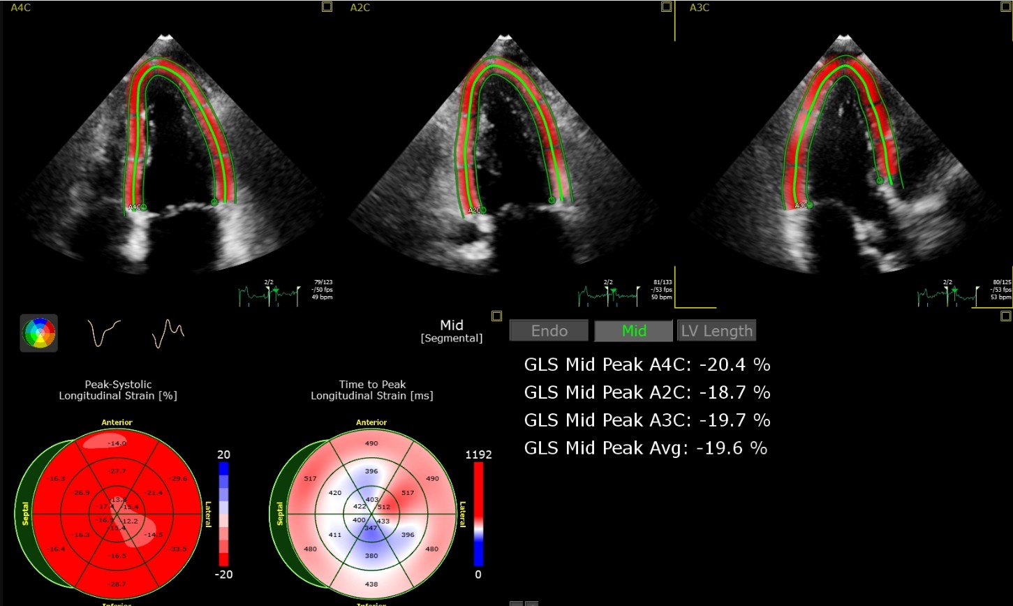 Echokardiographie Aurich - Ultraschall Herz Kardiologe Mina Attia